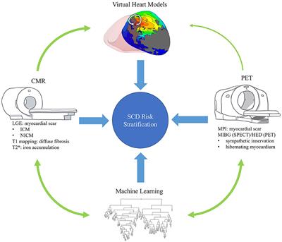 Advanced imaging for risk stratification for ventricular arrhythmias and sudden cardiac death